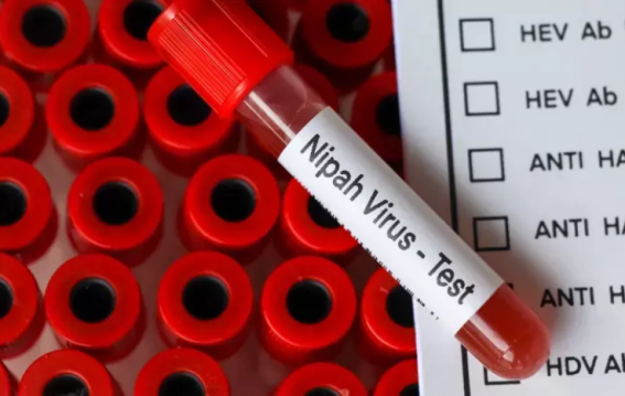 Nipah Virus Resurfaces in Kerala: 42-Year-Old Woman Critical Amid Fresh Health Concerns